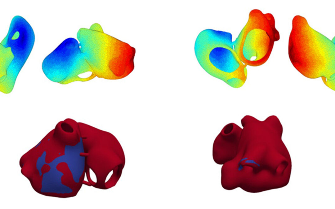 The Essence project revolutionises atrial fibrillation treatment