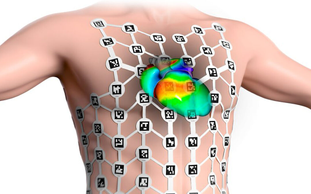 New advance in the treatment of cardiac arrhythmias