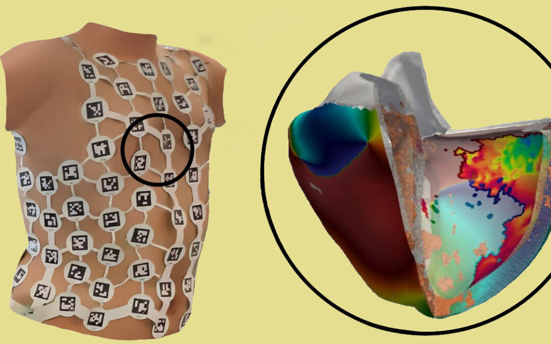 DIDIMO project develops digital cardiac twins to personalize arrhythmia treatment