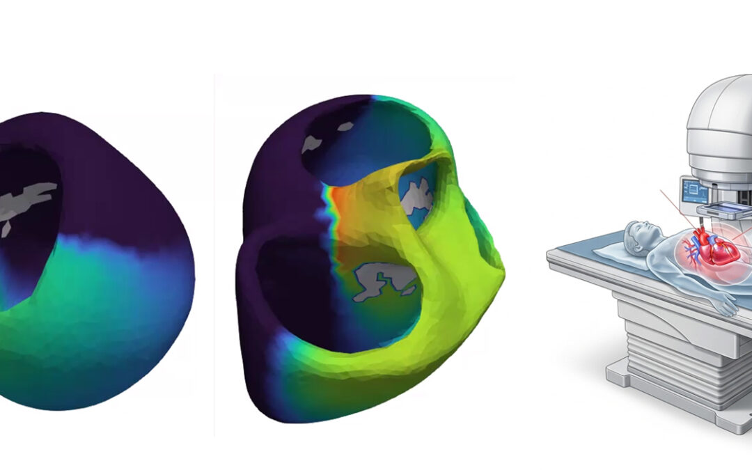 COR-ITACA improves the non-invasive cardiac therapies with AI and advanced imaging