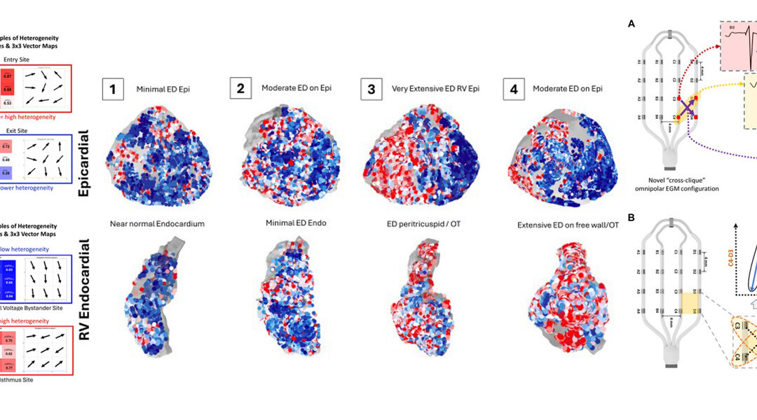 New research to detect hidden heart problems and improve their localisation