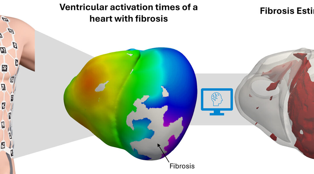 New non-Invasive technology to improve cardiac care