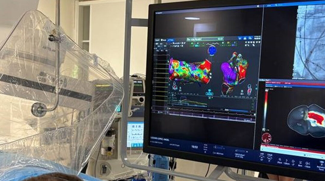 A global 4D cardiac mapping system with the ITACA-UPV seal, an international benchmark for the diagnosis of complex atrial and ventricular arrhythmias
